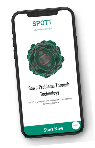 SPOTT (Penafian: Produk Pertandingan dan tidak boleh dimuat turun)